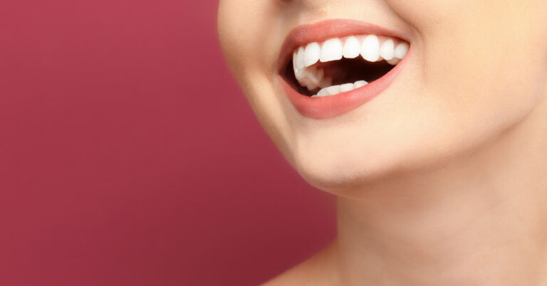 clareamento dental em ribeirão pires