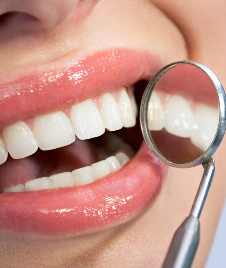Fechamento de Diastema em Ribeirão Pires fechamento de diastema