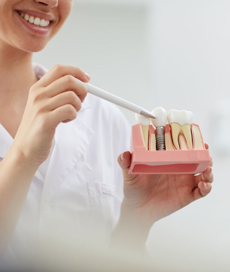Implante Dentário em Ribeirão Pires implante dentário