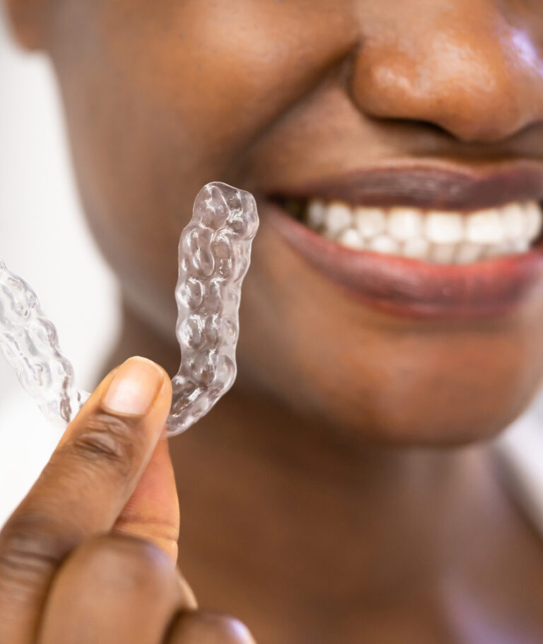 Invisalign em Ribeirão Pires o que e invisalign